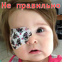 Не правильное использование глазного окклюдера